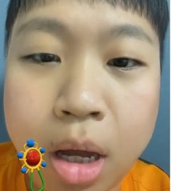 thumbimg
